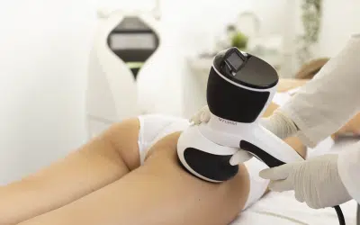 vform celulitis Radiofrecuencia corporal: cómo reafirmar la piel y reducir la celulitis sin cirugía